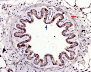 Expression of PAR-4 in rat lung