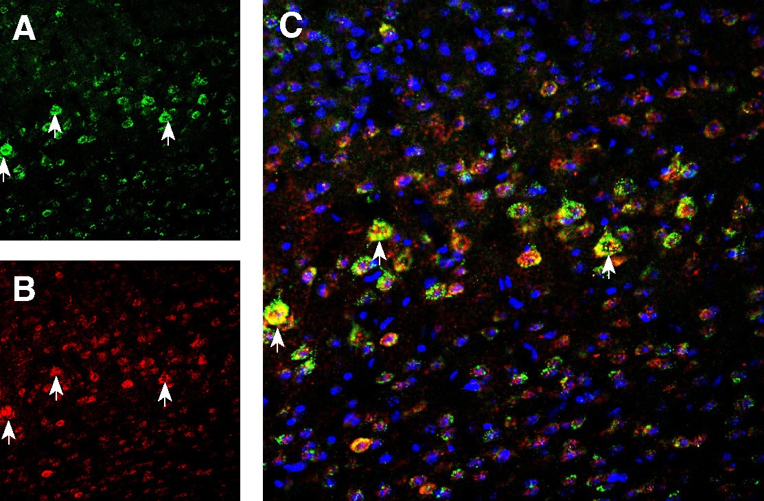 Multiplex staining of NMDA3B and NMDAR1 in mouse cortex