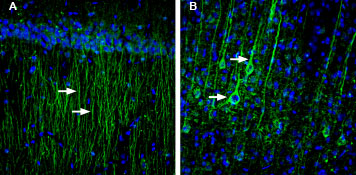 Expression of creatine transporter in rat hippocampus and cortex