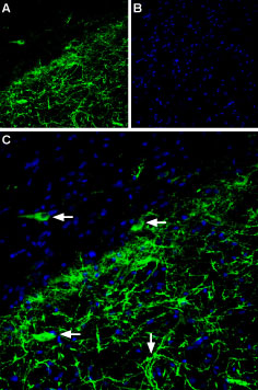 Expression of GIRK2 (K ir 3.2) in rat brain