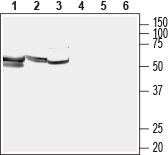 Western blot analysis of rat placenta lysate (lanes 1 and 4), mouse testes lysate (lanes 2 and 5) and rat skeletal muscle membrane (lanes 3 and 6):