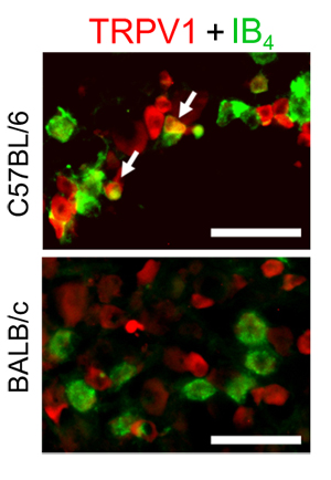 Differential expression of TRPV1 in C57BL/6 and BALB/c mice TG neurons.