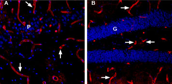 Expression of Aquaporin 4 in rat and mouse brain