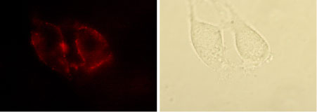 Expression of Angiotensin II Receptor Type-1 in rat C6 glioma cells