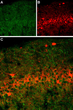 Expression of SERT in rat brain