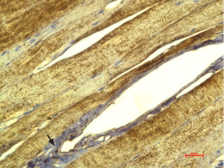 Expression of Ca V γ1 (CACNG1) in rat skeletal muscle