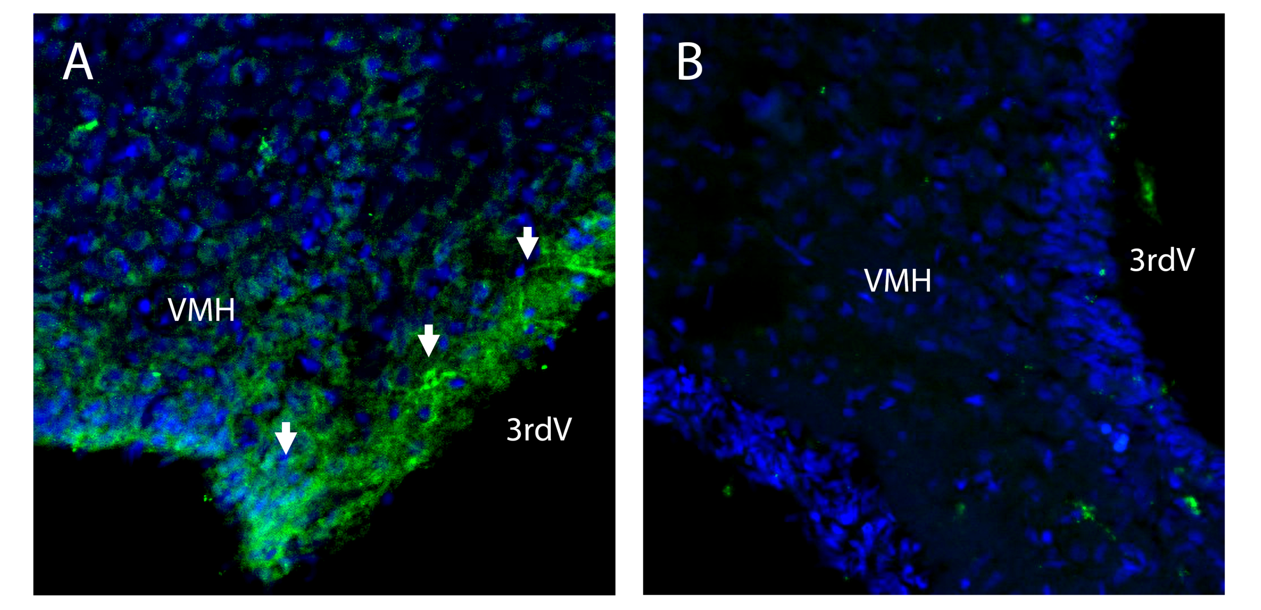 SLC7A1 in the rat hypothalamus