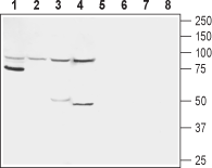 Western blot analysis of rat kidney (lanes 1 and 5), rat liver (lanes 2 and 6), mouse liver (lanes 3 and 7) and human HepG2 liver carcinoma cell line (lanes 4 and 8) lysates :