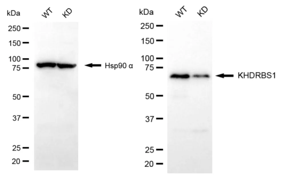 KVAb01301