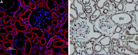 Expression of TRPP1 (PKD2) in rat kidney