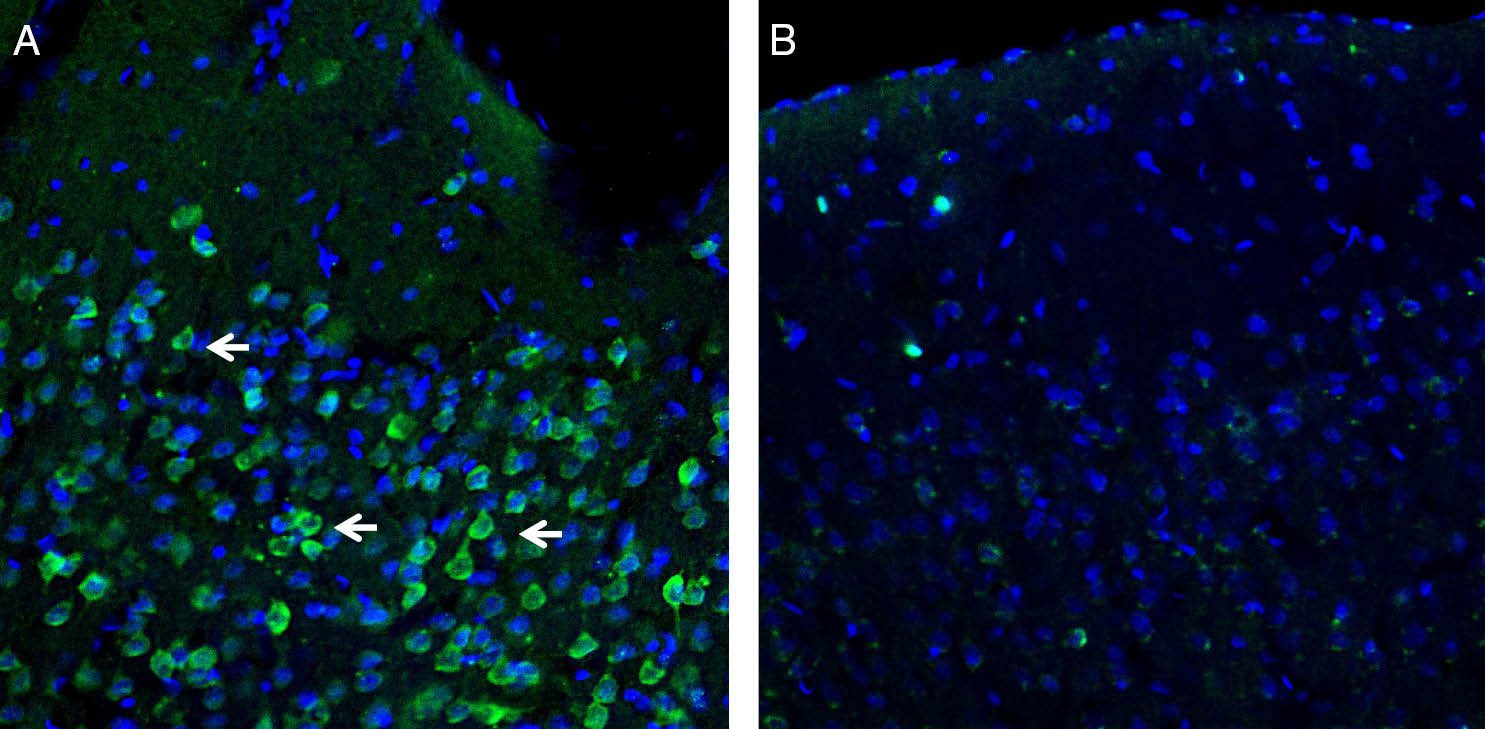 Expression of Orai1 in rat parietal cortex. <span class="EOP SCXW182593256 BCX0" data-ccp-props