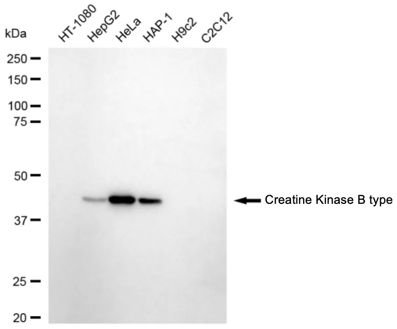 KVAb00792