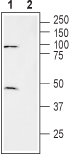 Western blot analysis of human brain glioblastoma cell line (U-87 MG) lysate: