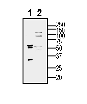 Western blot analysis of human U-87 MG glioblastoma cell line lysate (lane 1) and U-87 MG-derived purified exosomes (lane 2)