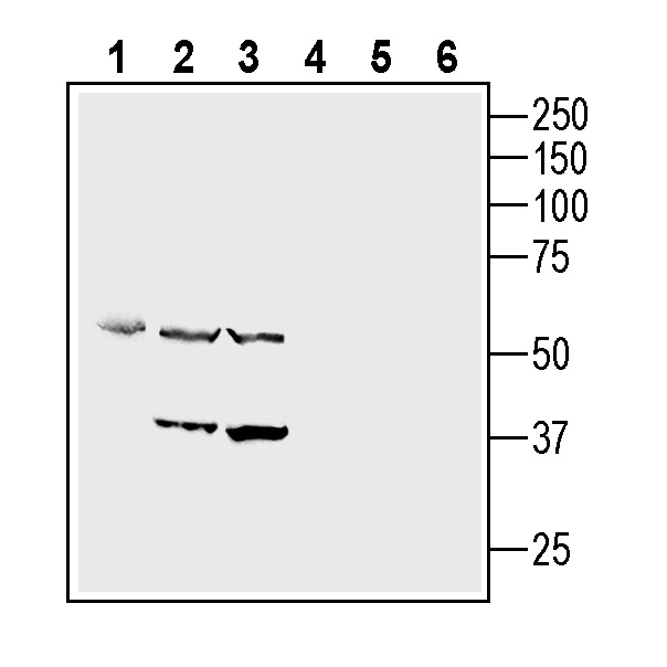 Western blot analysis of Mouse endothelial MS1 cell line lysate (lanes 1 and 4), rat aortic endothelial cell line (RAEC) lysates (lanes 2 and 5) and mouse J774 macrophage cell line lysates (lanes 3 and 6):