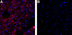 Expression of K Ca 2.3 (SK3) in rat brain