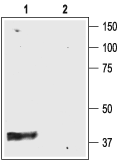 Western blot analysis of rat brain membranes: