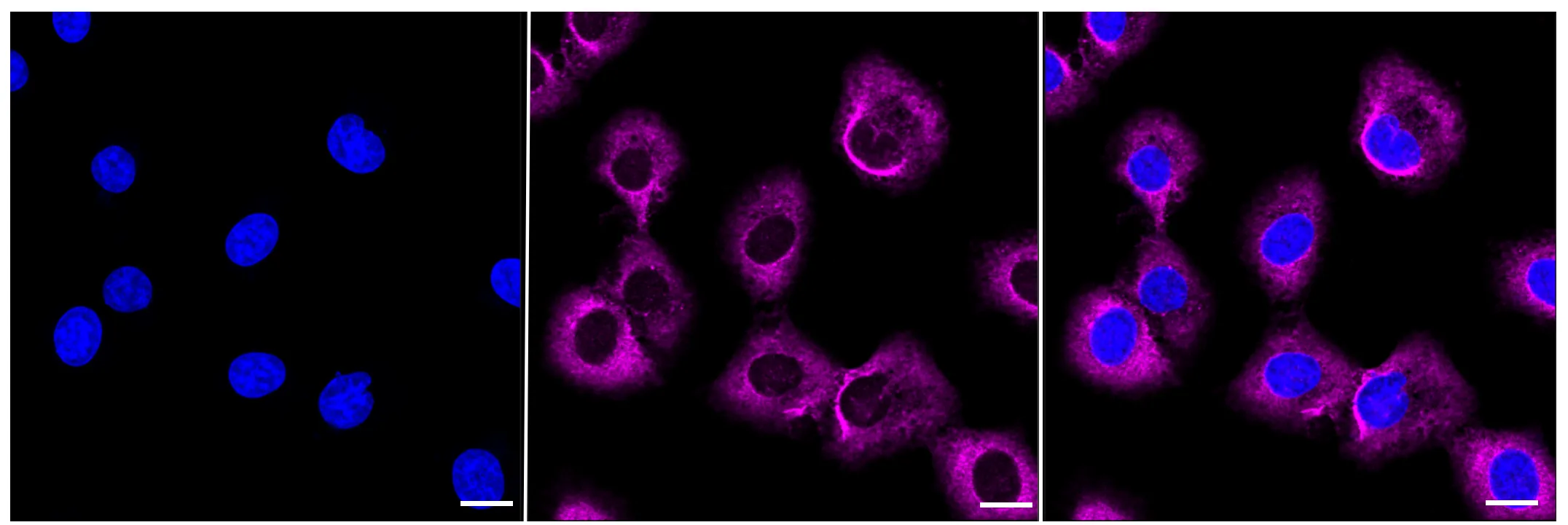 KVAb00190