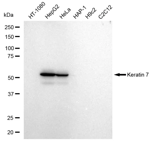 KVAb01700
