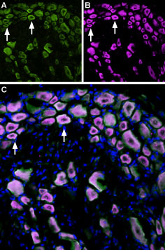 Multiplex staining of TRPM8 and TrkA in rat DRG
