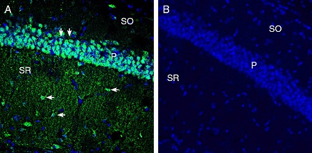 Expression of xCT/SLC7A11 in mouse hippocampus