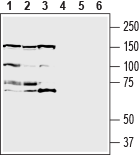 Western blot analysis of human MCF-7 breast adenocarcinoma cell line lysate (lanes 1 and 4), human U-87 MG glioblastoma cell line lysate (lanes 2 and 5) and human THP-1 monocytic leukemia cell line lysate (lanes 3 and 6):