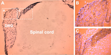 Expression of P2X3 Receptor in rat DRG neurons