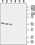 Western blot analysis of human HL-60 promyelocytic leukemia (lanes 1 and 4), human THP-1 acute monocytic leukemia (lanes 2 and 5) and human MEG-O1 Chronic myelogenous leukemia (lanes 3 and 6) cell lysates: