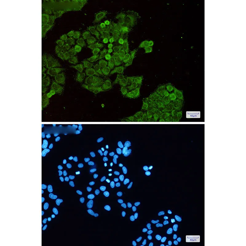 AMRe85514