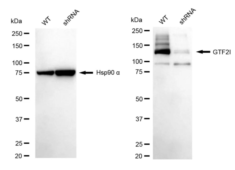 KVAb01055