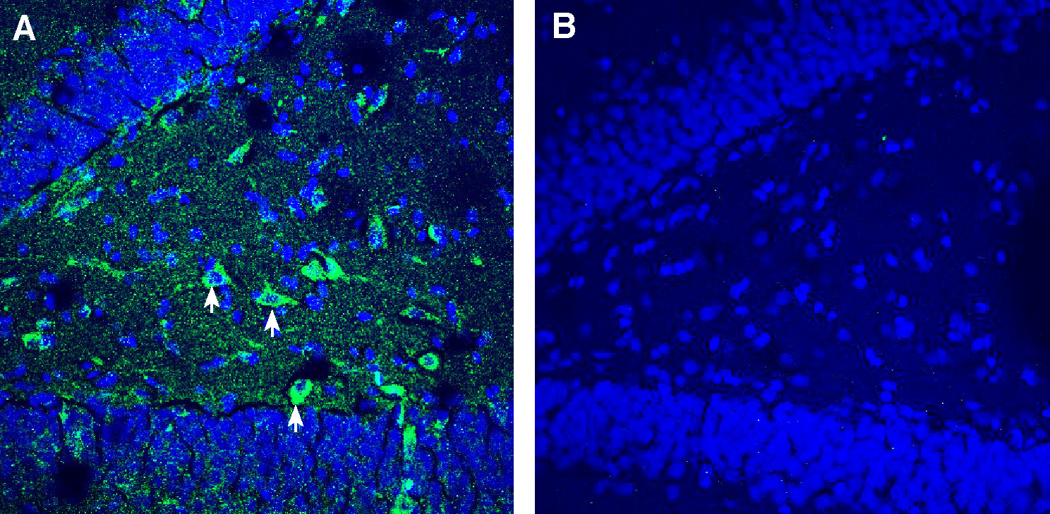 Expression of TMEM106B in mouse hippocampus.