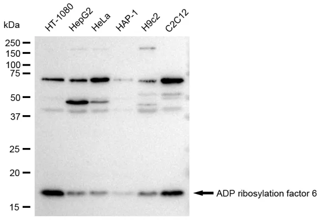 KVAb01594