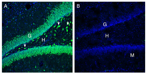 Expression of ATP1B3 in rat hippocampus.