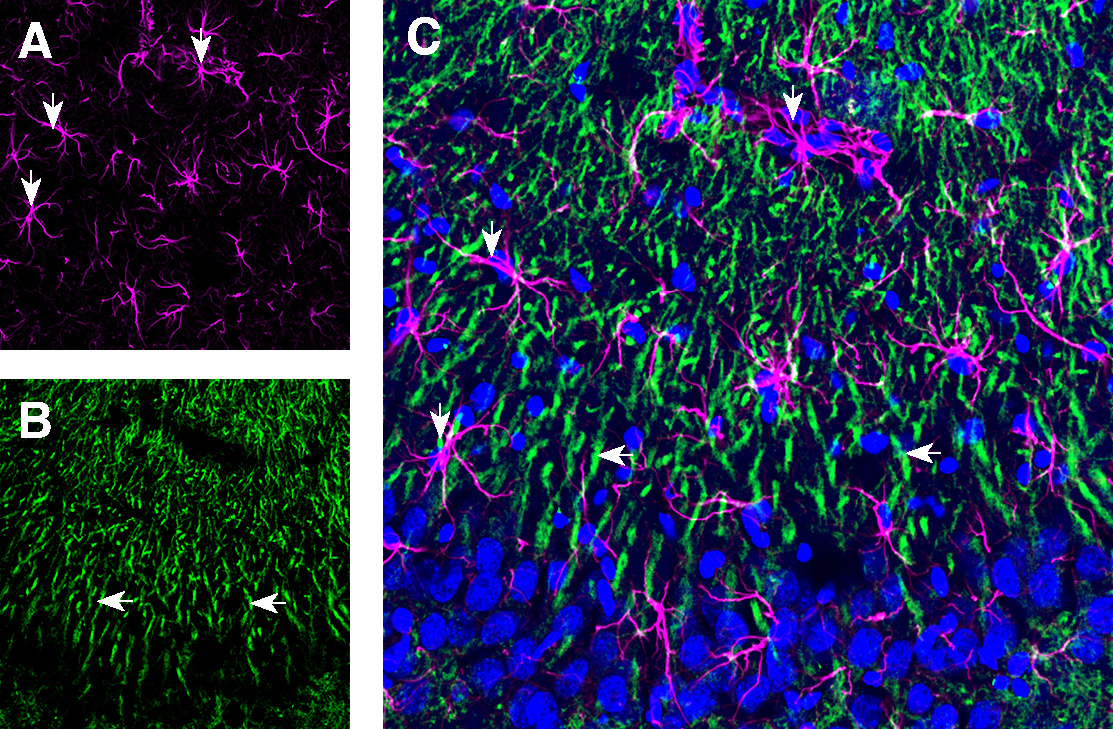 Expression of GFAP and 5HT1B Receptor in rat hippocampus CA3 region.