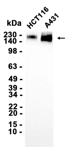 AMRe87061