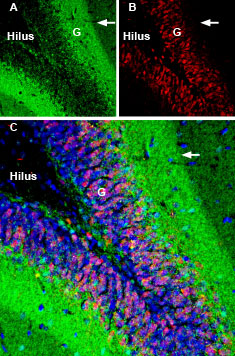 Expression of GAP43 in rat hippocampus