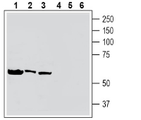 Western blot analysis of human HL-60 acute promyelocytic leukemia cell line lysate (lanes 1 and 4), human K562 erythroleukemia cell line lysate (lanes 2 and 5) and human Daudi Burkitt's lymphoma cell line lysate (lanes 3 and 6):