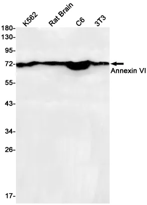 AMRe01651