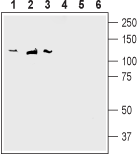 Western blot analysis of rat brain membranes (lanes 1 and 4), mouse brain membranes (lanes 2 and 5) and human SH-SY5Y neuroblastoma cell line lysate (lanes 3 and 6):