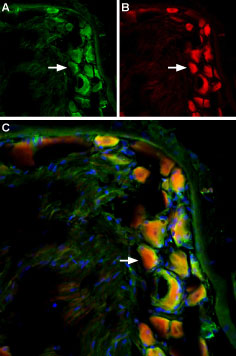 Multiplex staining of TRPV2 and mGluR5 in rat DRG