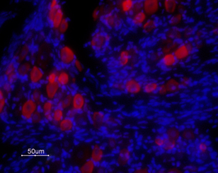 Expression of TRPV1 in rat DRG