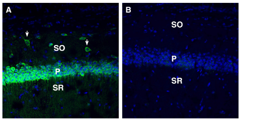 Expression of SORL1 in mouse hippocampus.