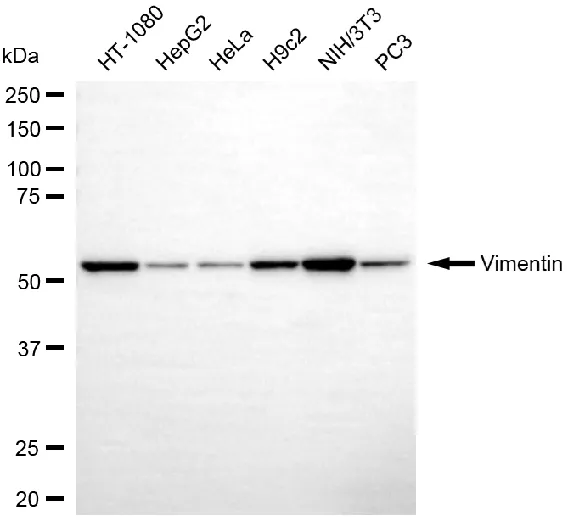 KVAb01455