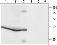 Western blot analysis of rat spleen (lanes 1 and4), rat pancreas (lanes 2 and 5) and mouse B-cell lymphoma (WEHI) (lanes 3 and 6) lysates: