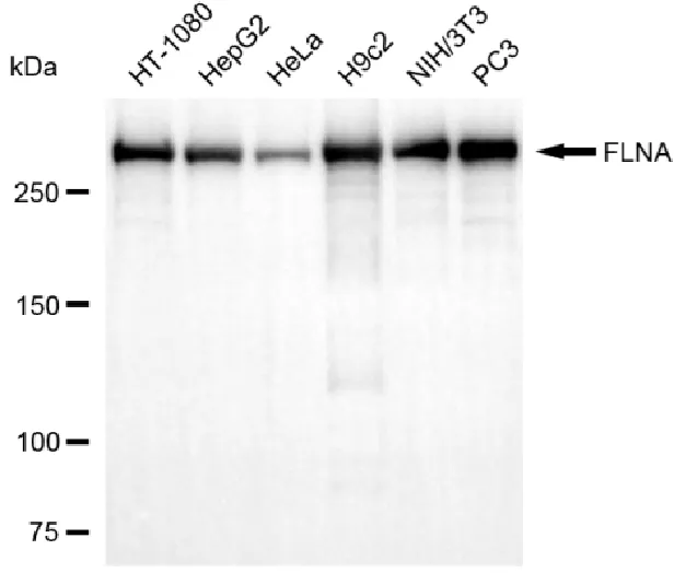 KVAb01615