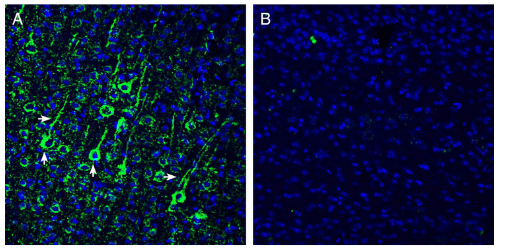 Expression of N-Cadherin in mouse cortex
