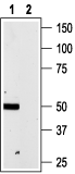 Western blot analysis of rat brain membranes: