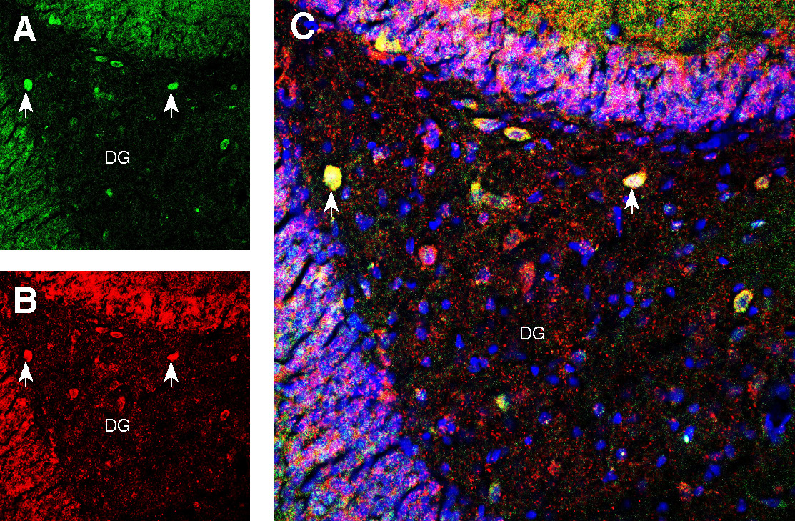 Multiplex staining of GluR1 and PICK1 in rat hippocampus.