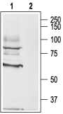 Western blot analysis of rat brain lysate: