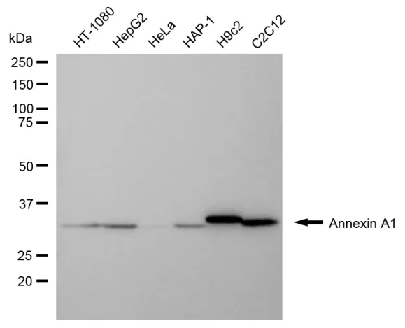 KVAb00613